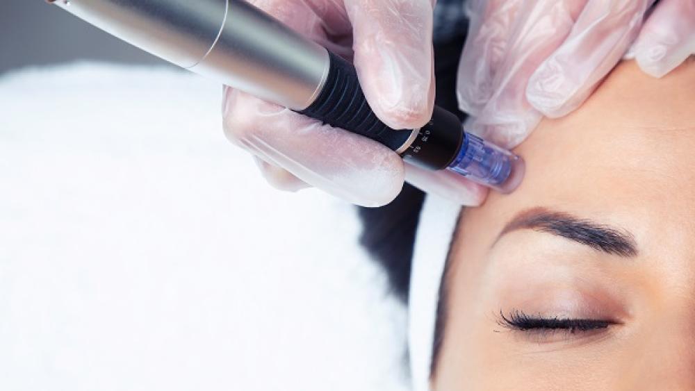 skin treatment on forehead
